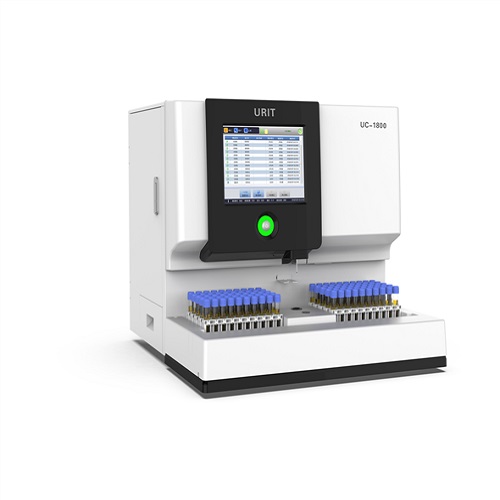 Macroscopic Urin Test Macroscopic urinalysis system - Image 1